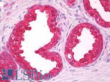 NOL3 / ARC Antibody - Anti-NOL3 antibody IHC of human prostate. Immunohistochemistry of formalin-fixed, paraffin-embedded tissue after heat-induced antigen retrieval. Antibody dilution 5 ug/ml.