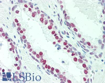 NOL4 Antibody - Human Prostate: Formalin-Fixed, Paraffin-Embedded (FFPE)