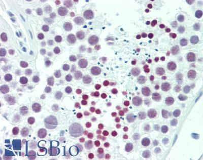 NOL4 Antibody - Human Testis: Formalin-Fixed, Paraffin-Embedded (FFPE)