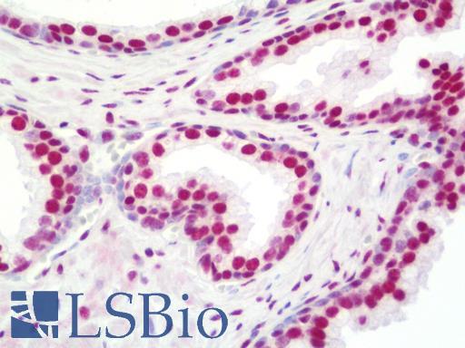 NONO / P54NRB Antibody - Anti-NONO / P54NRB antibody IHC staining of human prostate. Immunohistochemistry of formalin-fixed, paraffin-embedded tissue after heat-induced antigen retrieval. Antibody dilution 1:100.
