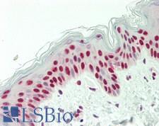 NONO / P54NRB Antibody - Human Skin: Formalin-Fixed, Paraffin-Embedded (FFPE)