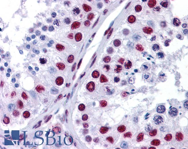 NONO / P54NRB Antibody - Anti-NONO antibody IHC of human testis. Immunohistochemistry of formalin-fixed, paraffin-embedded tissue after heat-induced antigen retrieval. Antibody concentration 3.75 ug/ml.