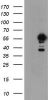 NONO / P54NRB Antibody - HEK293T cells were transfected with the pCMV6-ENTRY control (Left lane) or pCMV6-ENTRY NONO (Right lane) cDNA for 48 hrs and lysed. Equivalent amounts of cell lysates (5 ug per lane) were separated by SDS-PAGE and immunoblotted with anti-NONO.