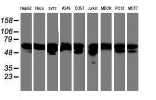 NONO / P54NRB Antibody - Western blot of extracts (35 ug) from 9 different cell lines by using g anti-NONO monoclonal antibody (HepG2: human; HeLa: human; SVT2: mouse; A549: human; COS7: monkey; Jurkat: human; MDCK: canine; PC12: rat; MCF7: human).