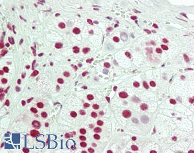 NONO / P54NRB Antibody - Human Adrenal: Formalin-Fixed, Paraffin-Embedded (FFPE)
