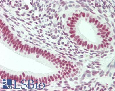 NONO / P54NRB Antibody - Human Uterus: Formalin-Fixed, Paraffin-Embedded (FFPE)