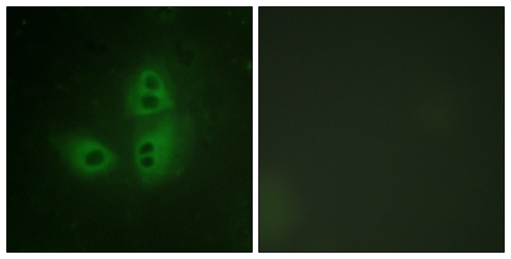 NOS1 / nNOS Antibody - Immunofluorescence analysis of HeLa cells, using nNOS Antibody. The picture on the right is blocked with the synthesized peptide.