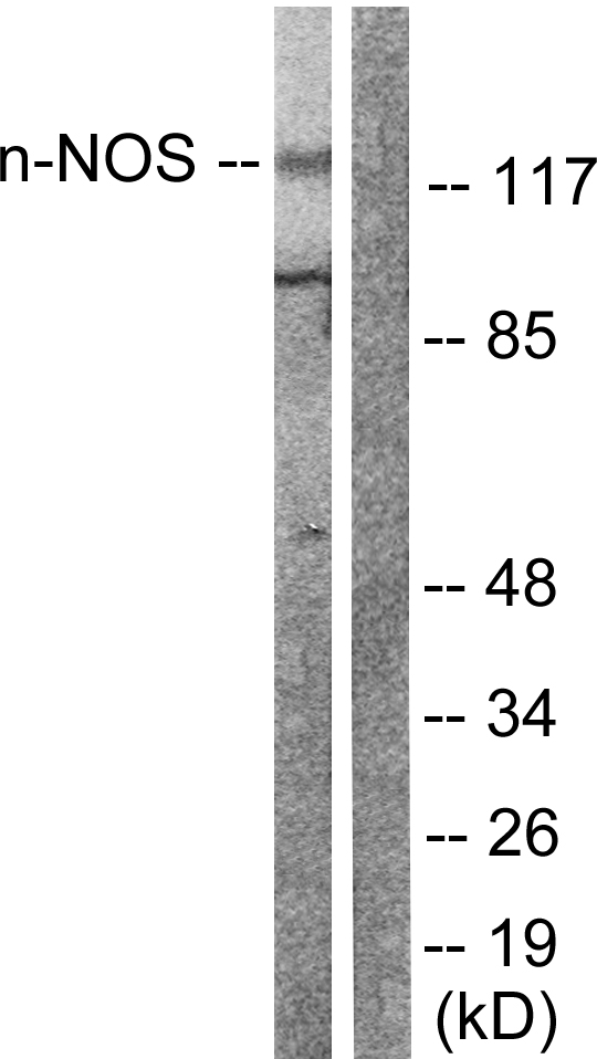 NOS1 / nNOS Antibody - Western blot analysis of lysates from Raw264.7 cells, treated with INF 2500u/ml 10', using nNOS Antibody. The lane on the right is blocked with the synthesized peptide.