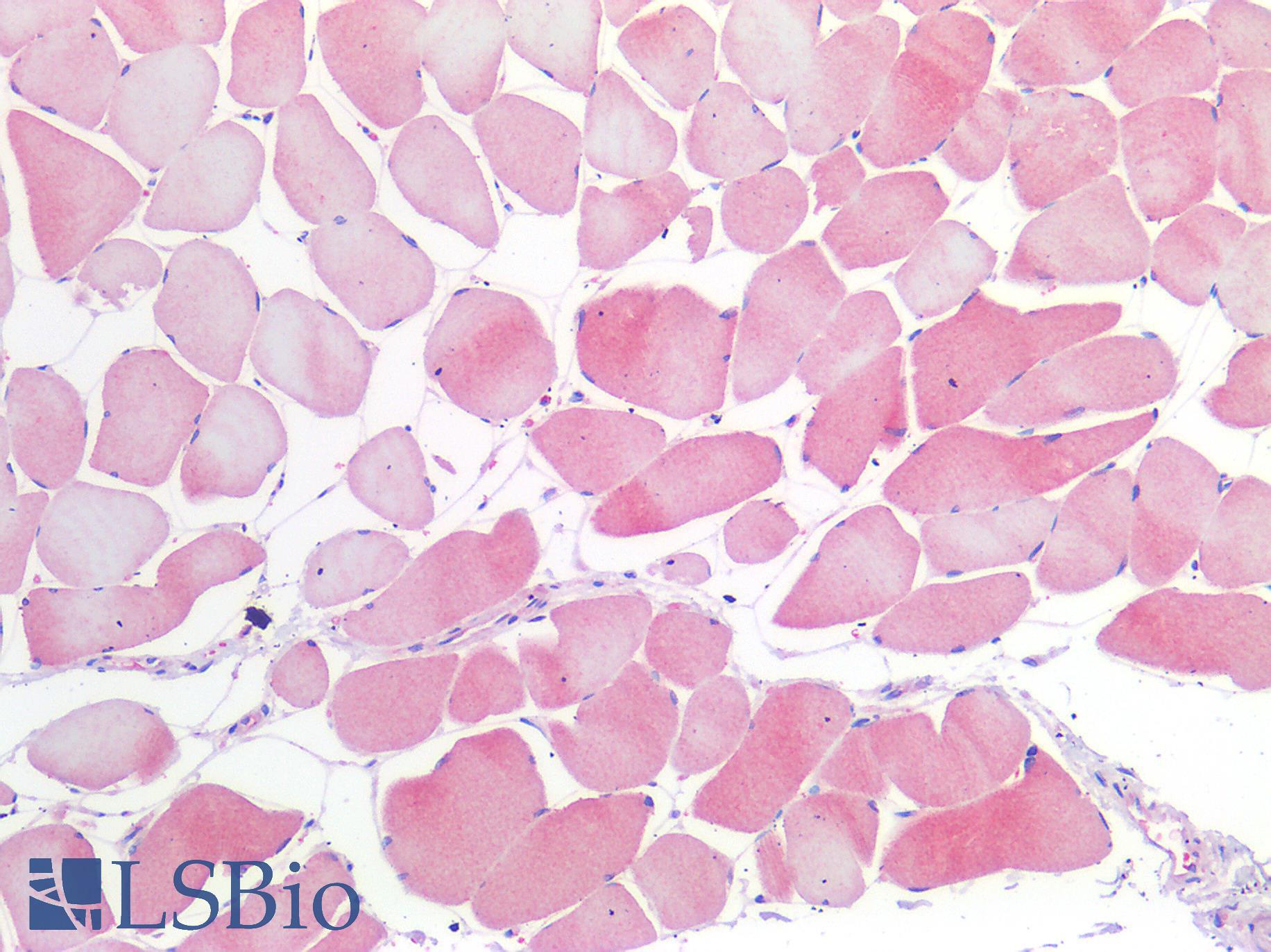NOS1 / nNOS Antibody - Human Skeletal Muscle: Formalin-Fixed, Paraffin-Embedded (FFPE)
