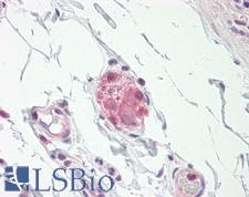 NOS1 / nNOS Antibody - Anti-NOS1 / nNOS antibody IHC staining of human small intestine, submucosal plexus. Immunohistochemistry of formalin-fixed, paraffin-embedded tissue after heat-induced antigen retrieval.