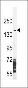 NOS2 / iNOS Antibody - NOS2A Antibody western blot of CEM cell line lysates (35 ug/lane). The NOS2A antibody detected the NOS2A protein (arrow).