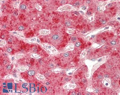 NOS2 / iNOS Antibody - Human Liver: Formalin-Fixed, Paraffin-Embedded (FFPE)