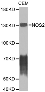 NOS2 / iNOS Antibody - Western blot analysis of CEM cell lysate using NOS2 antibody.