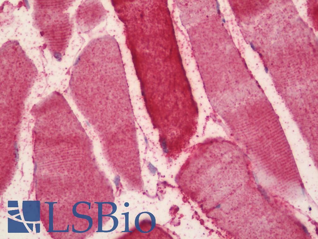 NOS2 / iNOS Antibody - Human Skeletal Muscle: Formalin-Fixed, Paraffin-Embedded (FFPE)
