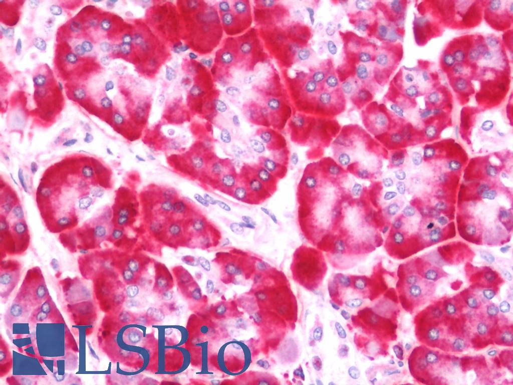 NOSTRIN Antibody - Human Pancreas: Formalin-Fixed, Paraffin-Embedded (FFPE)