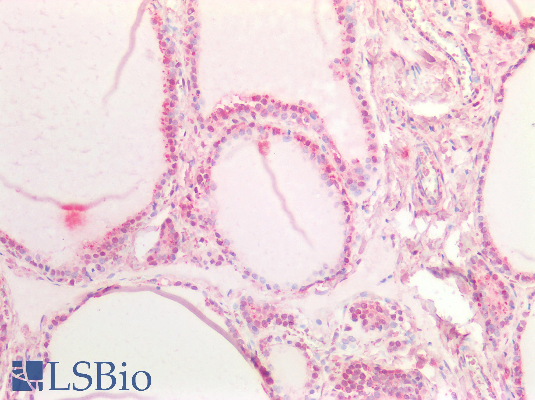 NOTCH1 Antibody - Human Thyroid: Formalin-Fixed, Paraffin-Embedded (FFPE)
