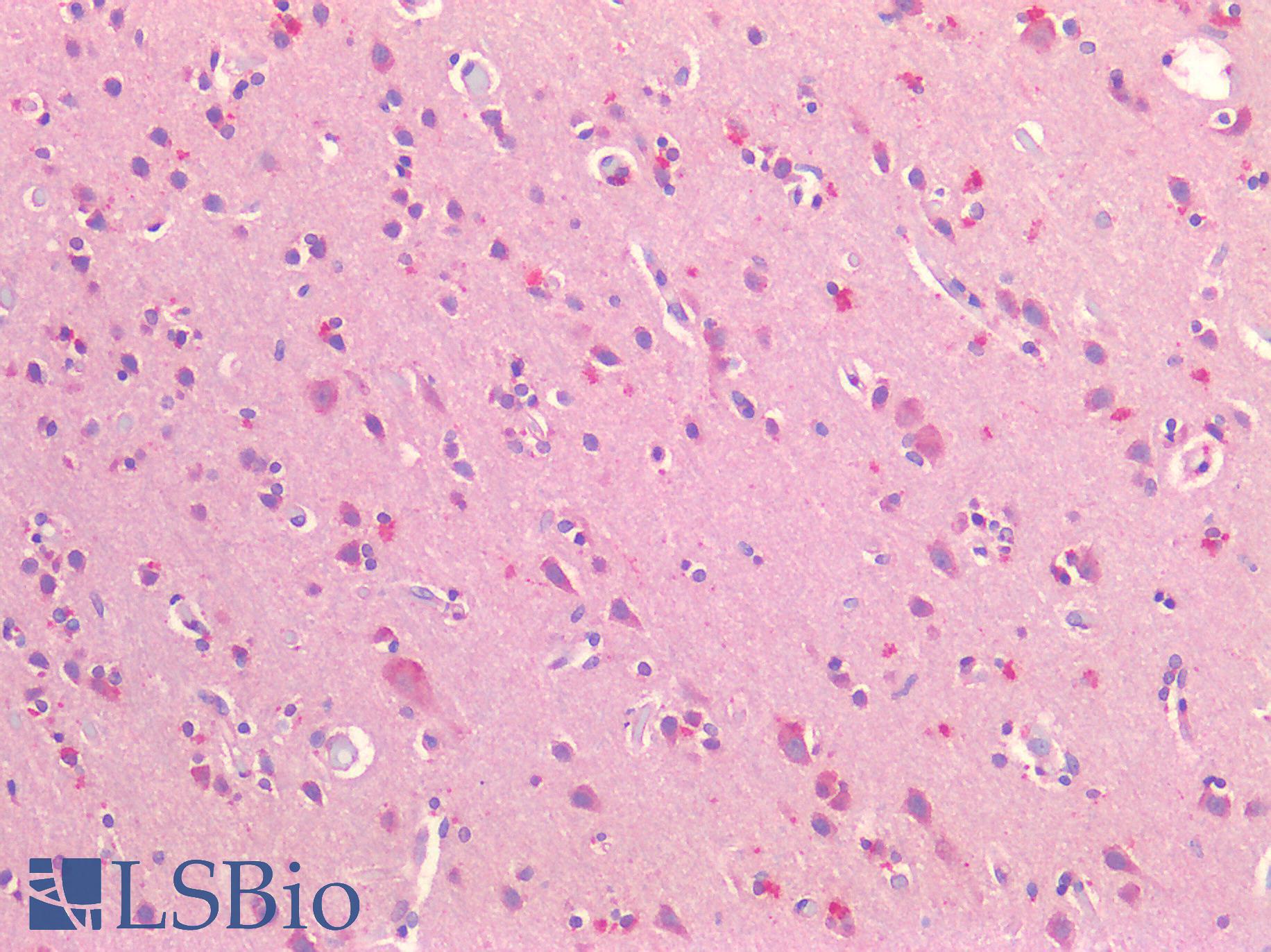 NOTCH2 Antibody - Human Brain, Cortex: Formalin-Fixed, Paraffin-Embedded (FFPE)