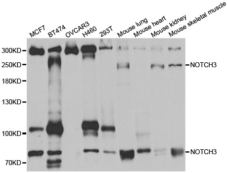 NOTCH3 Antibody - Western blot analysis of extracts of various cell lines, using NOTCH3 antibody.
