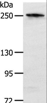 NOTCH3 Antibody - Western blot analysis of Human colon cancer tissue, using NOTCH3 Polyclonal Antibody at dilution of 1:400.