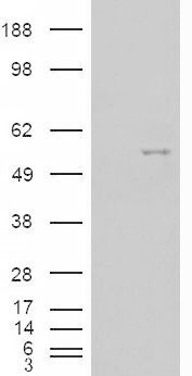 NOVA1 Antibody - HEK293 overexpressing NOVA1 (RC210407) and probed with (mock transfection in first lane).