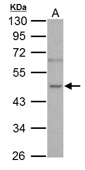 NOVA1 Antibody - Sample (30 ug of whole cell lysate). A: PC-3. 10% SDS PAGE. NOVA1 antibody diluted at 1:1000.