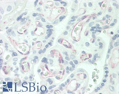 NOVA1 Antibody - Human Placenta: Formalin-Fixed, Paraffin-Embedded (FFPE)