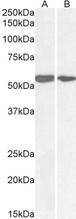NOX1 Antibody - NOX1 antibody (0.1µg/ml) staining of lysate of cell line colorectal adenocarcinoma (A) and HeLa (B) (35µg protein in RIPA buffer). Primary incubation was 1 hour. Detected by chemiluminescence.