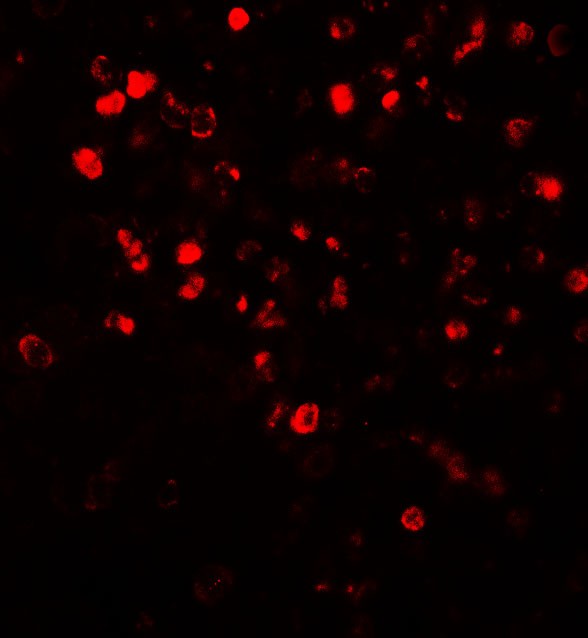 NOX4 Antibody - Immunofluorescence of NOX4 in human spleen tissue with NOX4 antibody at 20 ug/ml.