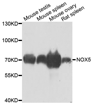 NOX5 Antibody - Western blot analysis of extracts of various cell lines.