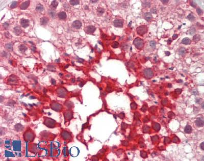 NOXO1 Antibody - Human Testis: Formalin-Fixed, Paraffin-Embedded (FFPE)