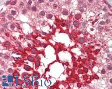 NOXO1 Antibody - Human Testis: Formalin-Fixed, Paraffin-Embedded (FFPE)