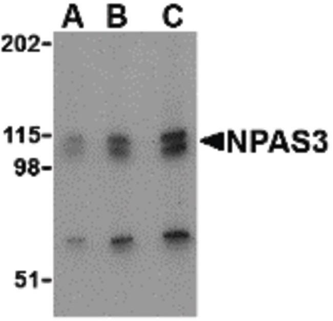 NPAS3 Antibody - Western blot of NPAS3 in SK-N-SH cell lysate with NPAS3 antibody at (A) 0.5, (B) 1 and (C) 2 ug/ml.
