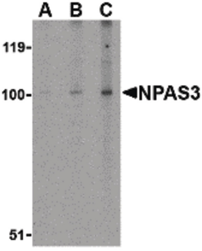 NPAS3 Antibody - Western blot of NPAS3 in rat brain tissue lysate with NPAS3 antibody at (A) 0.5, (B) 1 and (C) 2 ug/ml.