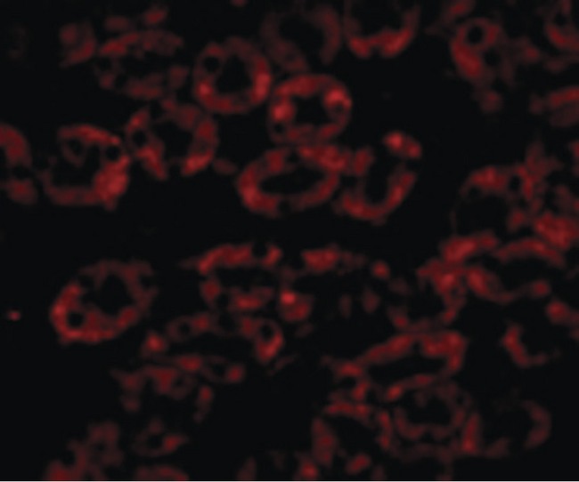 NPC / NPC1 Antibody - Immunofluorescence of NPC1 in Mouse Kidney cells with NPC1 antibody at 20 ug/ml.