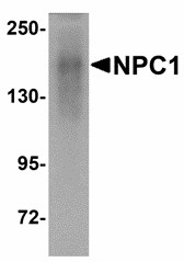 NPC / NPC1 Antibody - Western blot of NPC1 in human kidney tissue lysate with NPC1 antibody at 1 ug/ml. Below: Immunohistochemistry of NPC1 in mouse kidney tissue with NPC1 antibody at 2.5 ug/ml.