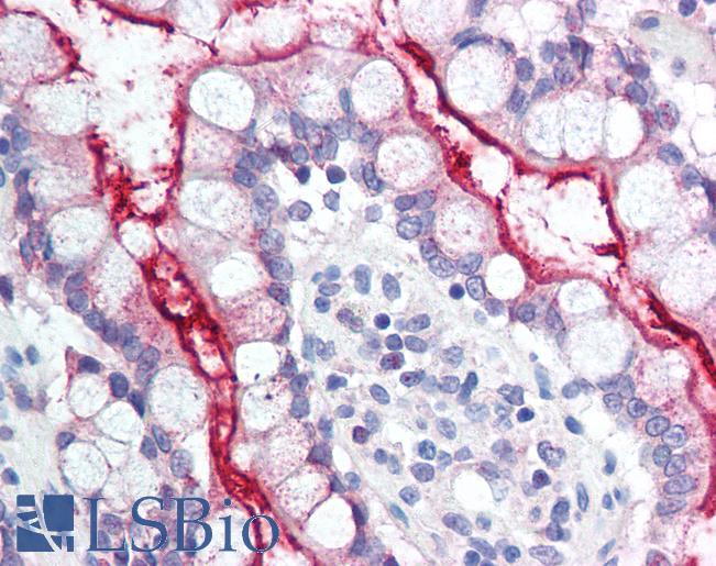 NPC1L1 Antibody - Anti-NPC1L1 antibody IHC of human small intestine. Immunohistochemistry of formalin-fixed, paraffin-embedded tissue after heat-induced antigen retrieval. Antibody concentration 20 ug/ml. This image was taken for the unconjugated form of this product. Other forms have not been tested.