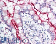 NPC1L1 Antibody - Anti-NPC1L1 antibody IHC of human small intestine. Immunohistochemistry of formalin-fixed, paraffin-embedded tissue after heat-induced antigen retrieval. Antibody concentration 20 ug/ml. This image was taken for the unconjugated form of this product. Other forms have not been tested.