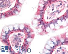 NPC1L1 Antibody - Anti-NPC1L1 antibody IHC of human small intestine. Immunohistochemistry of formalin-fixed, paraffin-embedded tissue after heat-induced antigen retrieval. Antibody concentration 20 ug/ml.  This image was taken for the unconjugated form of this product. Other forms have not been tested.