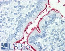 NPC1L1 Antibody - Anti-NPC1L1 antibody IHC staining of human small intestine. Immunohistochemistry of formalin-fixed, paraffin-embedded tissue after heat-induced antigen retrieval.