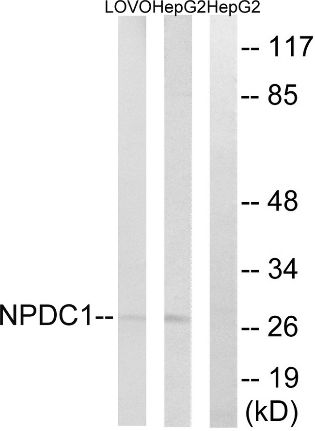 NPDC1 Antibody - Western blot analysis of lysates from HepG2 and LOVO cells, using NPDC1 Antibody. The lane on the right is blocked with the synthesized peptide.