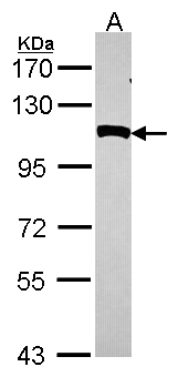 NPEPPS Antibody - Sample (30 ug of whole cell lysate). A: Hela. 7.5% SDS PAGE. NPEPPS antibody diluted at 1:1000.