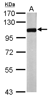 NPEPPS Antibody - Sample (50 ug of whole cell lysate). A: Mouse brain. 7.5% SDS PAGE. NPEPPS antibody diluted at 1:1000.