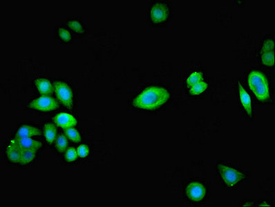 NPHP1 / Nephronophthisis Antibody - Immunofluorescent analysis of PC-3 cells using NPHP1 Antibody at dilution of 1:100 and Alexa Fluor 488-congugated AffiniPure Goat Anti-Rabbit IgG(H+L)