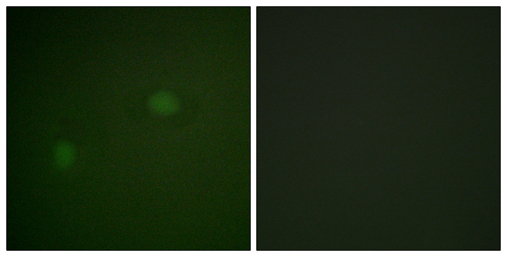 NPM1 / NPM / Nucleophosmin Antibody - Immunofluorescence analysis of HeLa cells, using NPM Antibody. The picture on the right is blocked with the synthesized peptide.