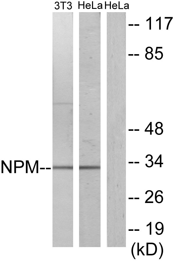 NPM1 / NPM / Nucleophosmin Antibody - Western blot analysis of lysates from HeLa and NIH/3T3 cells, using NPM Antibody. The lane on the right is blocked with the synthesized peptide.