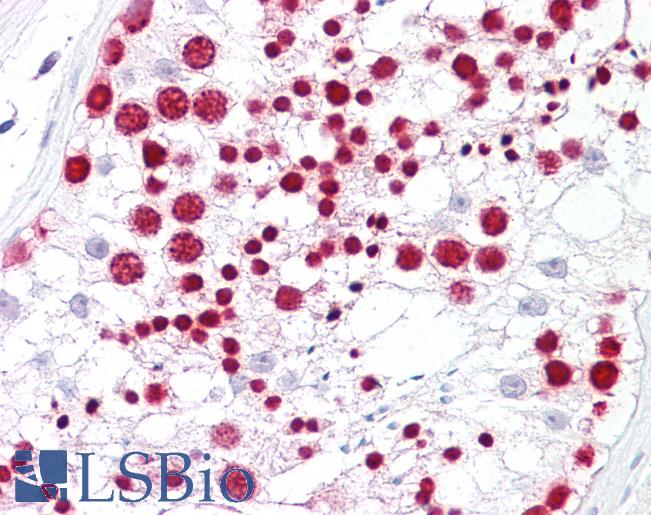 NPM1 / NPM / Nucleophosmin Antibody - Anti-NPM1 antibody IHC of human testis. Immunohistochemistry of formalin-fixed, paraffin-embedded tissue after heat-induced antigen retrieval. Antibody dilution 1:100.