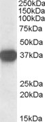 NPM1 / NPM / Nucleophosmin Antibody - Staining (0.1?g/ml) of Jurkat lysate (RIPA buffer, 35?g total protein per lane). Primary incubated for 1 hour. Detected by chemiluminescence.
