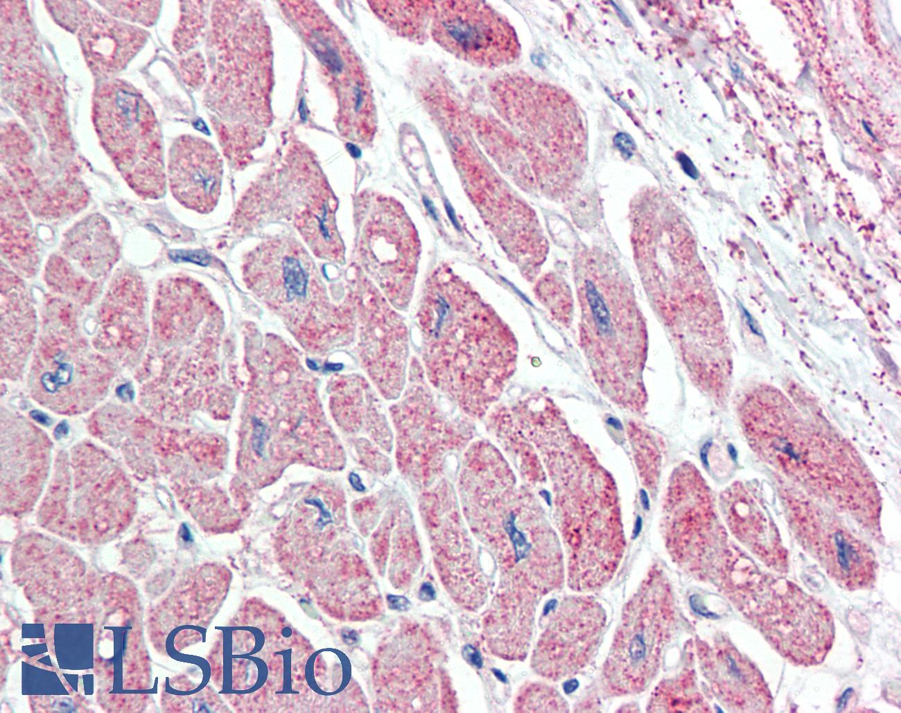 NPPA / ANP Antibody - Anti-NPPA / ANP antibody IHC staining of human heart. Immunohistochemistry of formalin-fixed, paraffin-embedded tissue after heat-induced antigen retrieval. Antibody concentration 5 ug/ml.