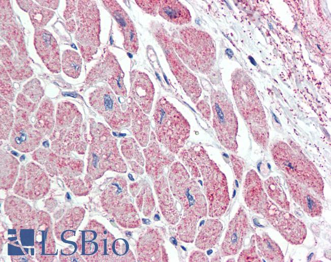 NPPA / ANP Antibody - Anti-NPPA / ANP antibody IHC staining of human heart. Immunohistochemistry of formalin-fixed, paraffin-embedded tissue after heat-induced antigen retrieval. Antibody concentration 5 ug/ml.