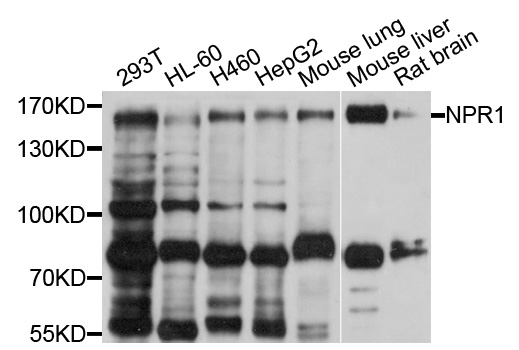 NPRA / NPR1 Antibody - Western blot analysis of extracts of various cell lines, using NPR1 antibody at 1:1000 dilution. The secondary antibody used was an HRP Goat Anti-Rabbit IgG (H+L) at 1:10000 dilution. Lysates were loaded 25ug per lane and 3% nonfat dry milk in TBST was used for blocking. An ECL Kit was used for detection and the exposure time was 40s.
